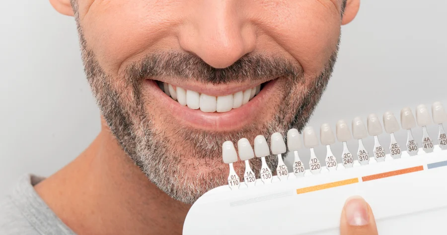 Teeth Whitening Scale