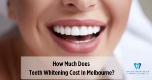 How Much Does Teeth Whitening Cost In Endeavour Hills?