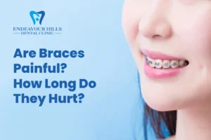 Are Braces Painful? How Long Do They Hurt?