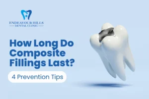 How Long Do Composite Fillings Last? 4 Prevention Tips