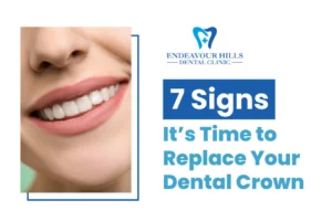 7 Signs It’s Time to Replace Your Dental Crown