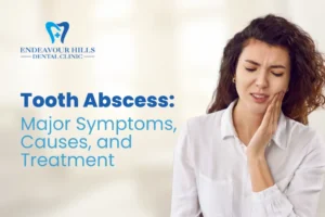 Tooth Abscess: Major Symptoms, Causes, and Treatment