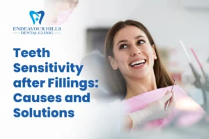 Teeth Sensitivity after Fillings: Causes and Solutions