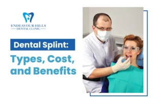 Dental Splint: Types, Cost, and Benefits