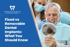 Fixed vs Removable Dental Implants: What You Should Know