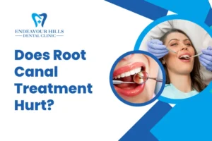 Does Root Canal Treatment Hurt?