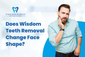 Does Wisdom Teeth Removal Change Face Shape?