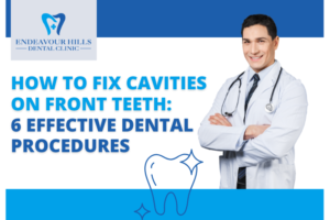 How to Fix Cavities on Front Teeth: 6 Effective Dental Procedures