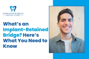 What’s an Implant-Retained Bridge? Here’s What You Need to Know