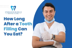 How Long After a Tooth Filling Can You Eat? 