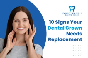 10 Signs Your Dental Crown Needs Replacement