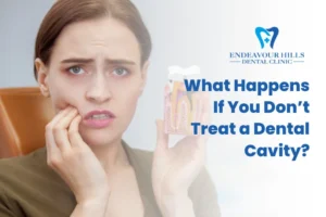 What Happens If You Don’t Treat a Dental Cavity?