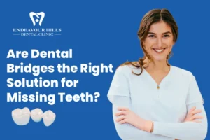Are Dental Bridges the Right Solution for Missing Teeth?