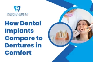How Dental Implants Compare to Dentures in Comfort