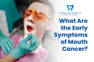 What Are the Early Symptoms of Mouth Cancer?