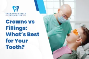 Crowns vs Fillings: What’s Best for Your Tooth?