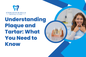 Understanding Plaque and Tartar: What You Need to Know
