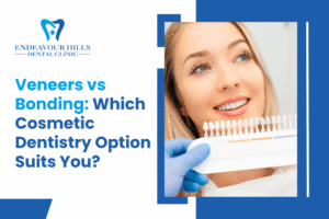 Veneers vs Bonding: Which Cosmetic Dentistry Option Suits You?