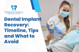 Dental Implant Recovery: Timeline, Tips and What to Avoid