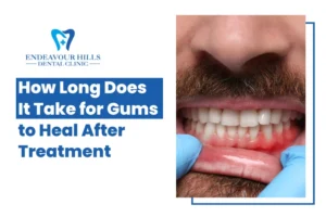 How Long Does It Take for Gums to Heal After Treatment