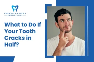 What to Do If Your Tooth Cracks in Half