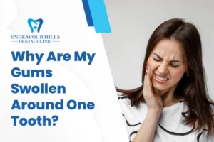 Why Are My Gums Swollen Around One Tooth?