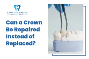 Can a Crown Be Repaired Instead of Replaced?